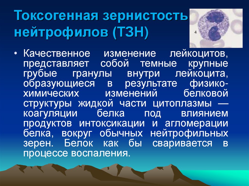 Токсогенная зернистость нейтрофилов (ТЗН)