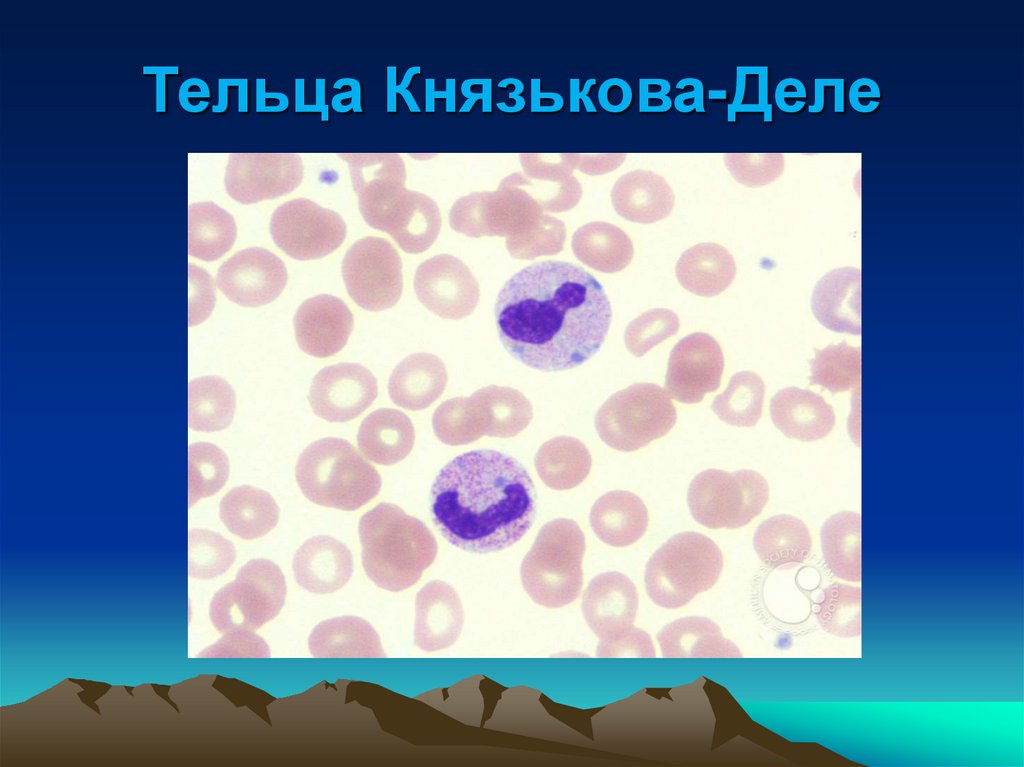 Тельца Князькова-Деле