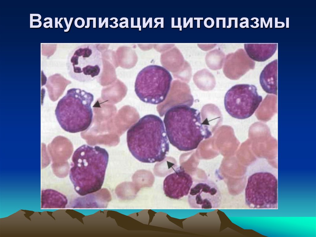 Вакуолизация цитоплазмы