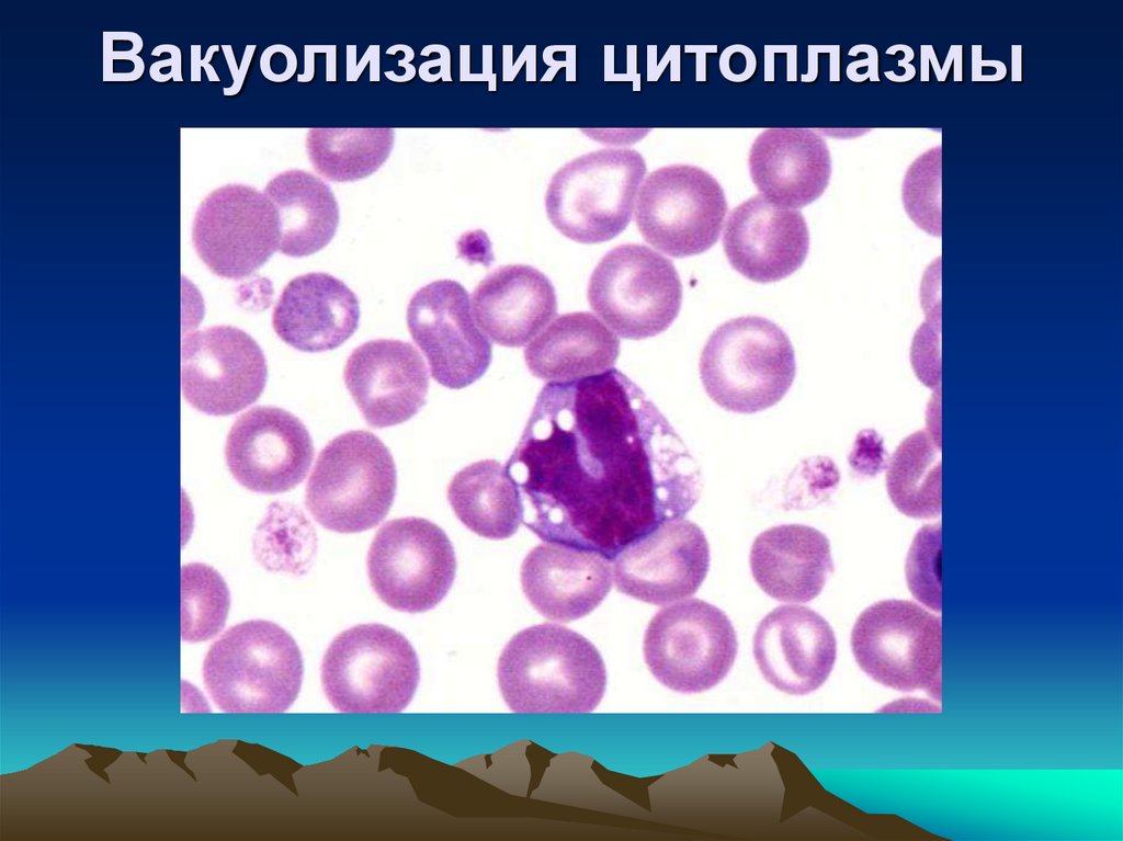 Вакуолизация цитоплазмы