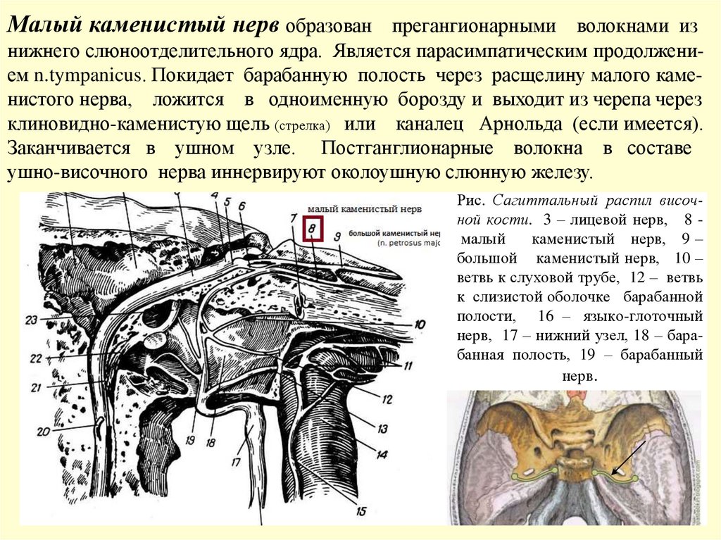 Рис. Сагиттальный распил височ- ной кости. 3 – лицевой нерв, 8 - малый каменистый нерв, 9 – большой каменистый нерв, 10 – ветвь