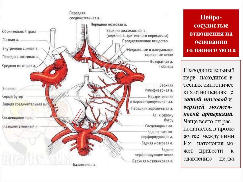 Глазодвигательный нерв находится в тесных синтопичес ких отношениях с задней мозговой и верхней мозжеч- ковой артериями. Чаще