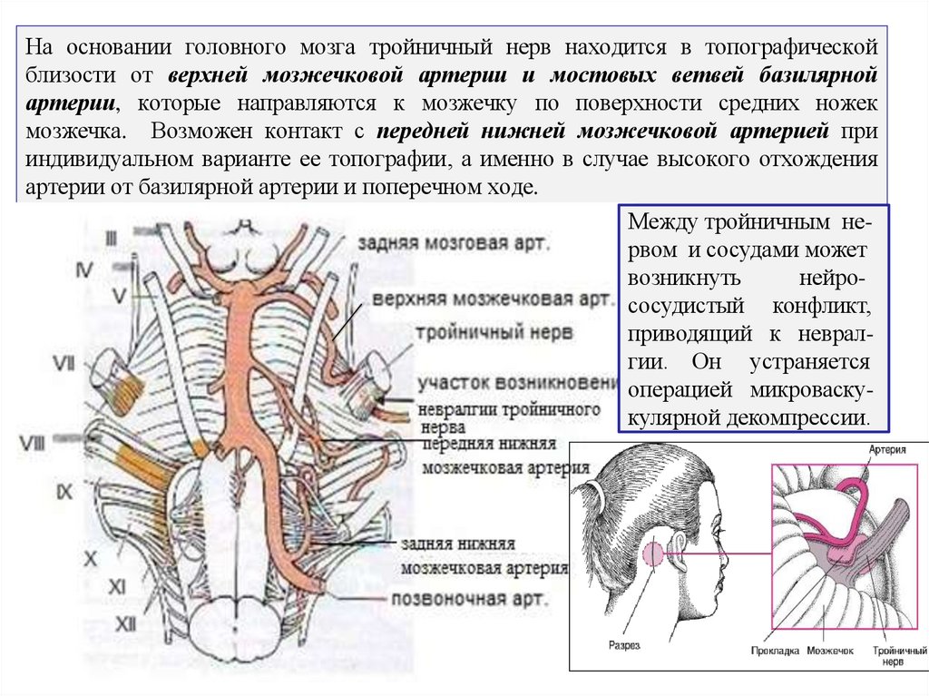 На основании головного мозга тройничный нерв находится в топографической близости от верхней мозжечковой артерии и мостовых