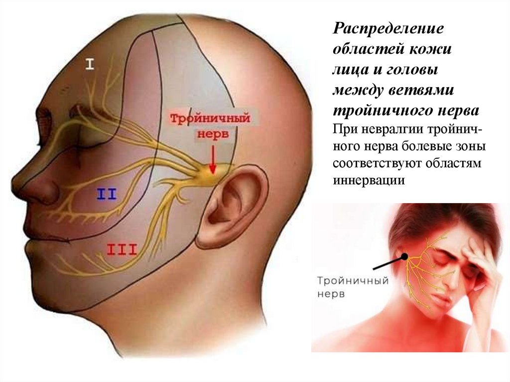Распределение областей кожи лица и головы между ветвями тройничного нерва При невралгии тройнич- ного нерва болевые зоны