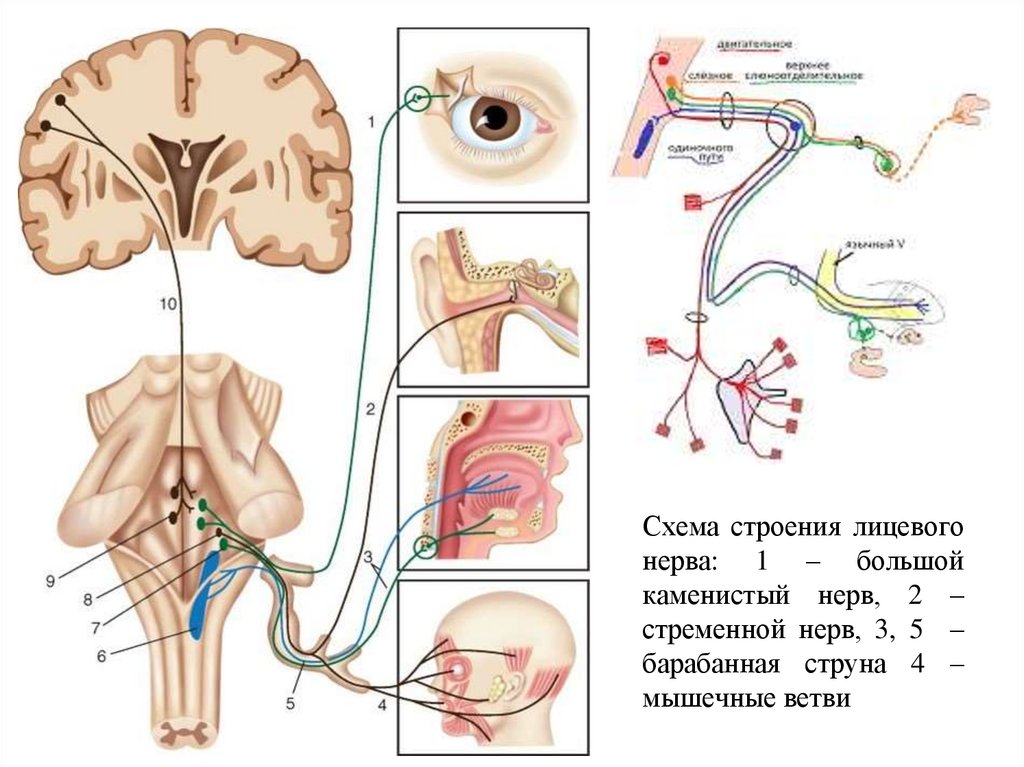Схема строения лицевого нерва: 1 – большой каменистый нерв, 2 – стременной нерв, 3, 5 – барабанная струна 4 – мышечные ветви