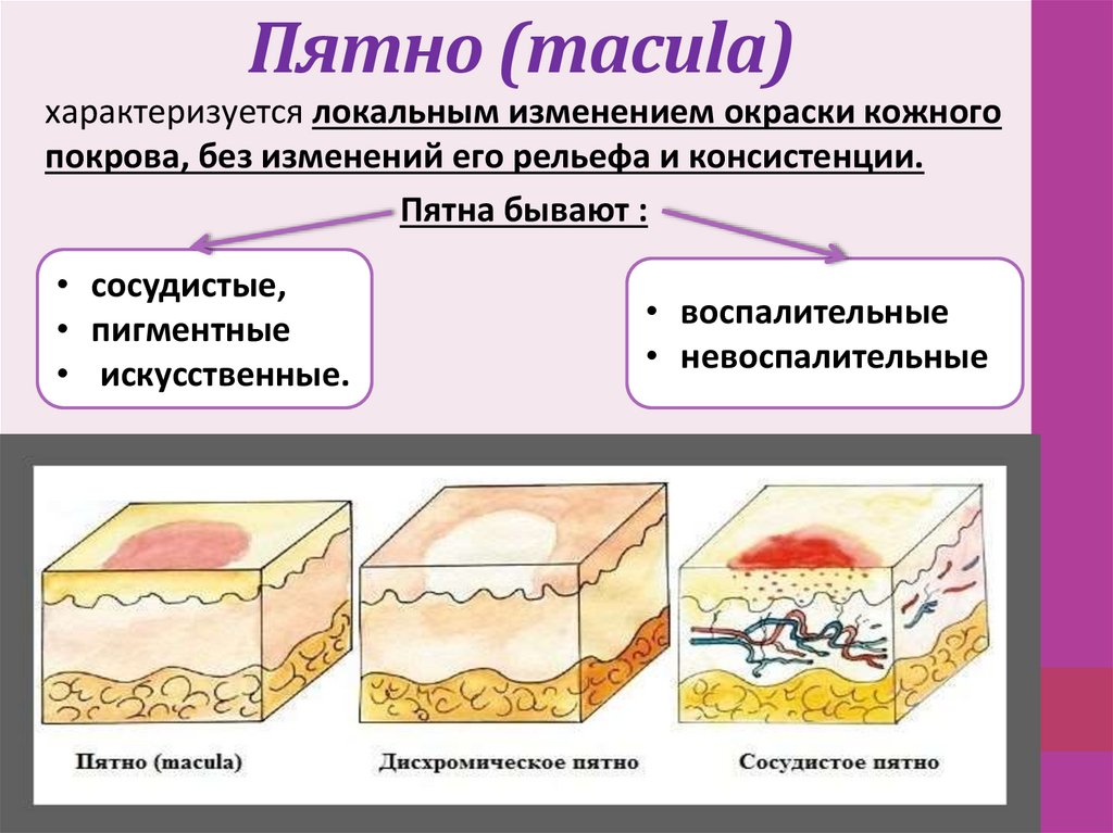 Пятно (macula)