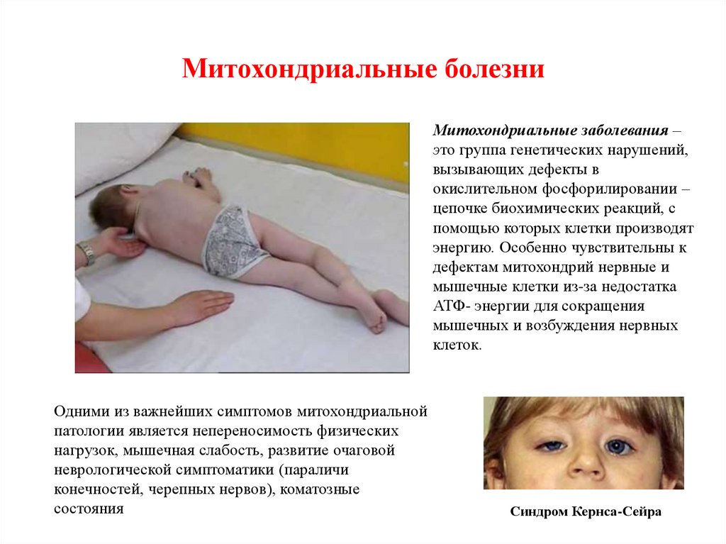 Митохондриальные болезни