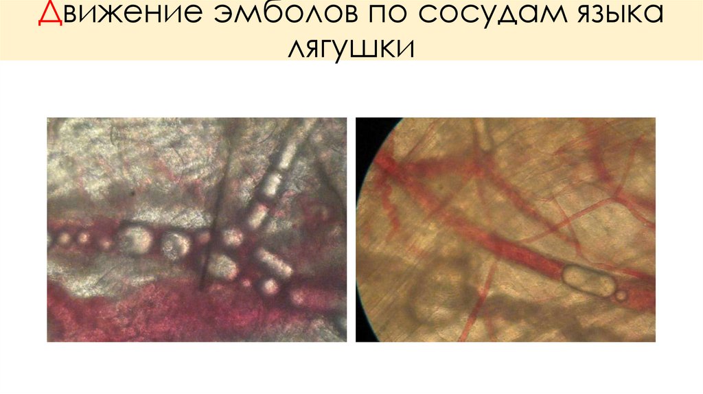 Движение эмболов по сосудам языка лягушки