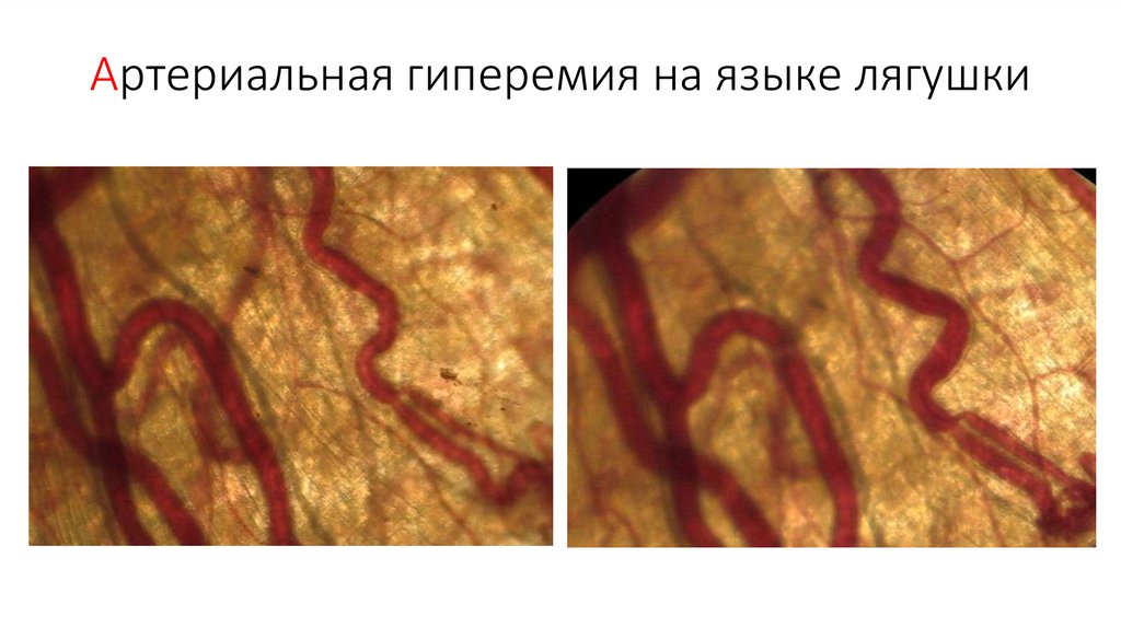 Артериальная гиперемия на языке лягушки