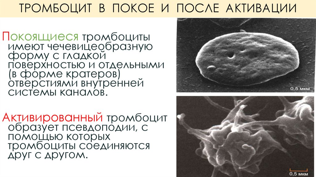 ТРОМБОЦИТ В ПОКОЕ И ПОСЛЕ АКТИВАЦИИ