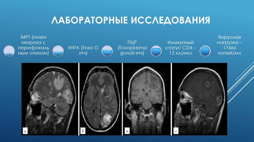 Лабораторные исследования