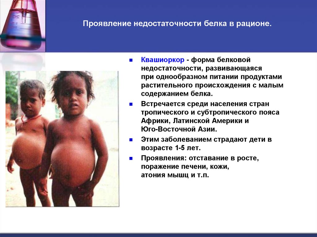 Проявление недостаточности белка в рационе.