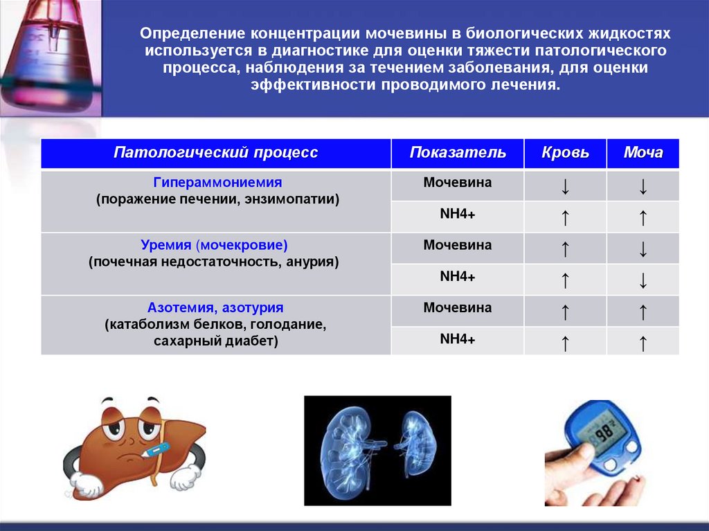 Определение концентрации мочевины в биологических жидкостях используется в диагностике для оценки тяжести патологического