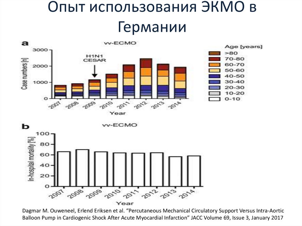 Опыт использования ЭКМО в Германии