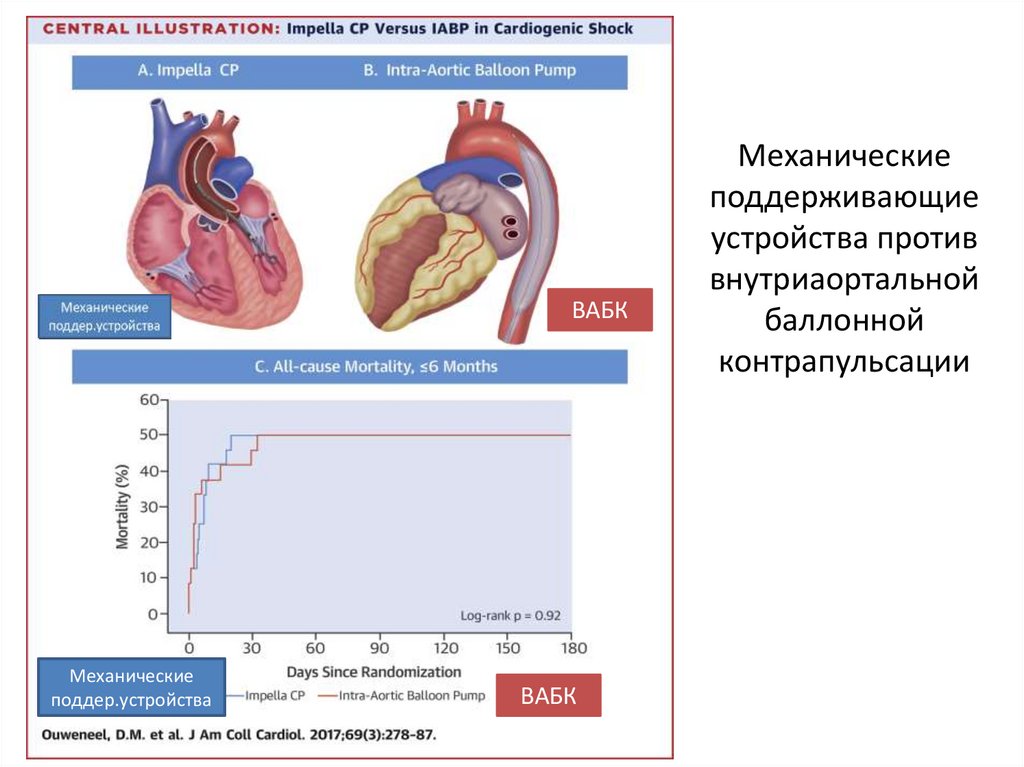 Механические поддерживающие устройства против внутриаортальной баллонной контрапульсации