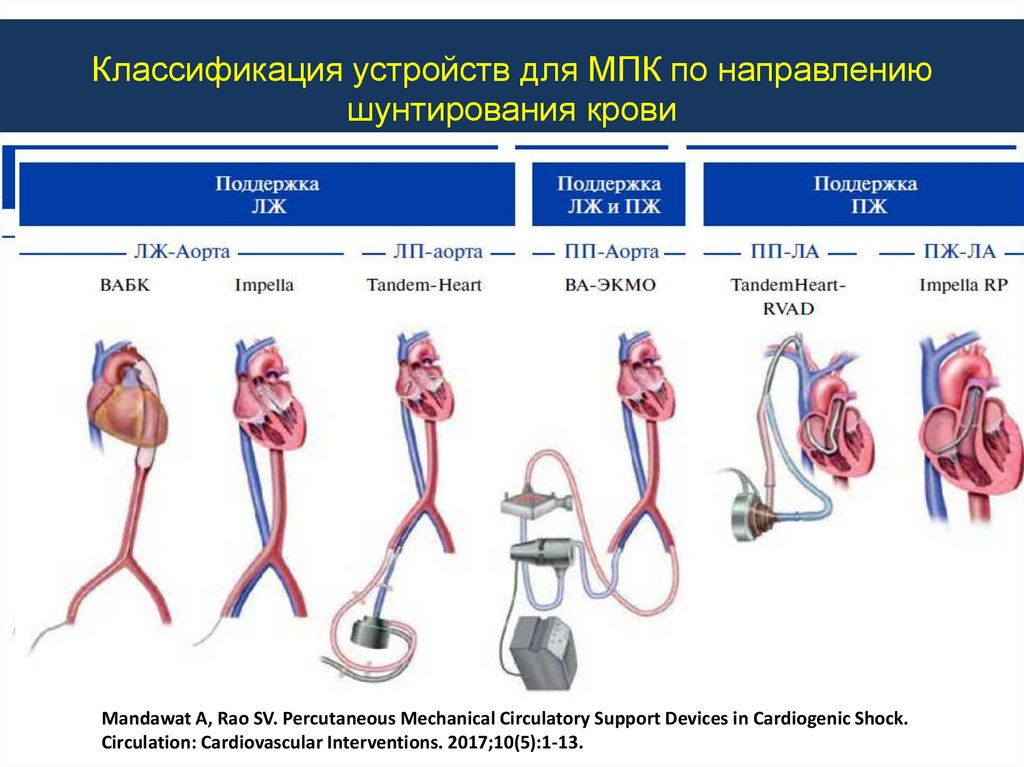Классификация устройств для МПК по направлению шунтирования крови