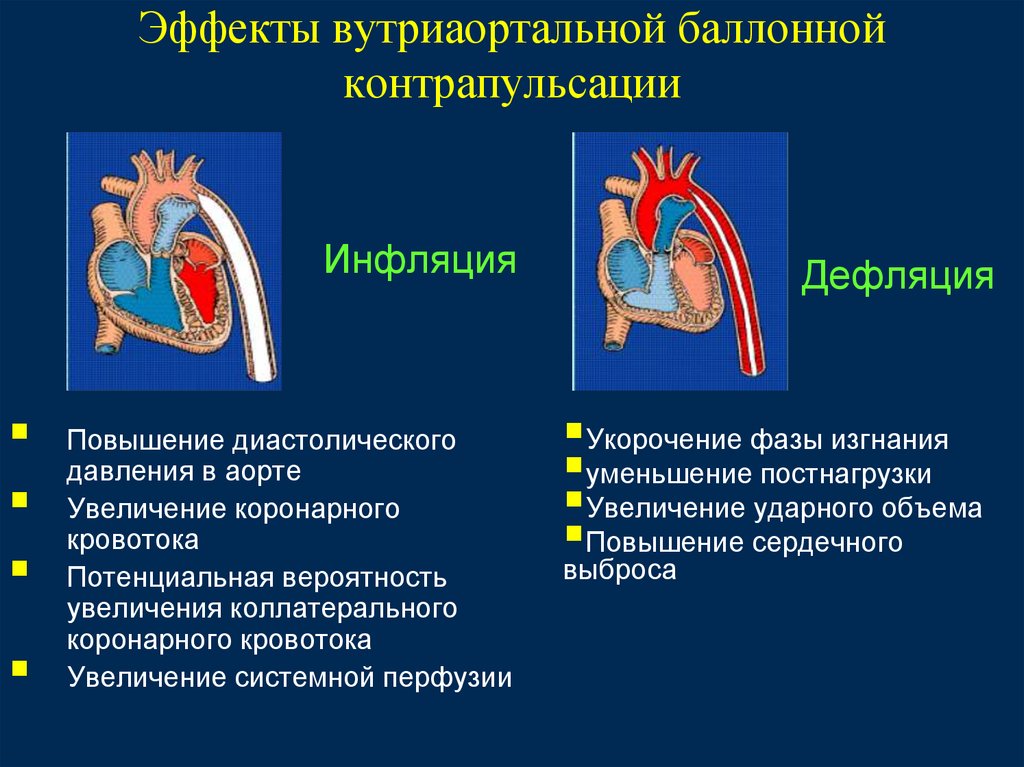 Эффекты вутриаортальной баллонной контрапульсации