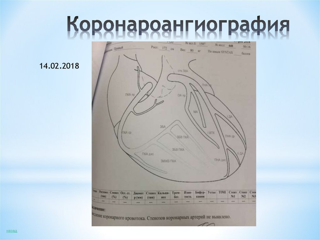 Коронароангиография