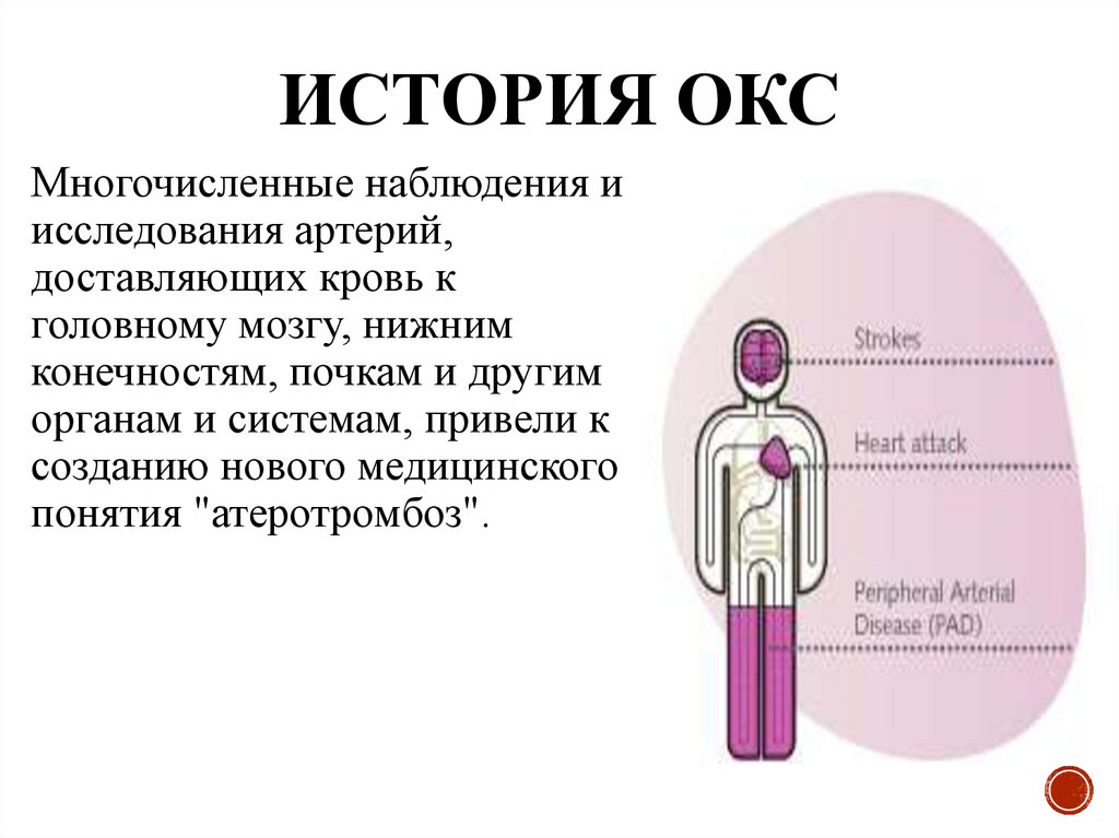 История ОКС