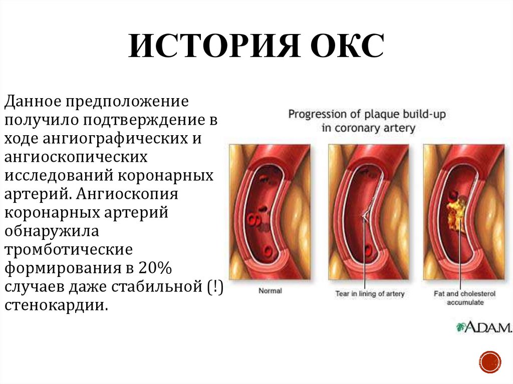 История ОКС