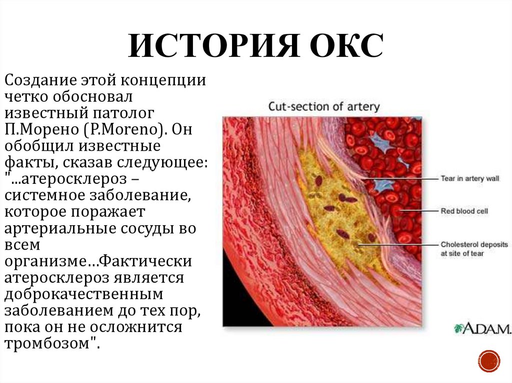 История ОКС