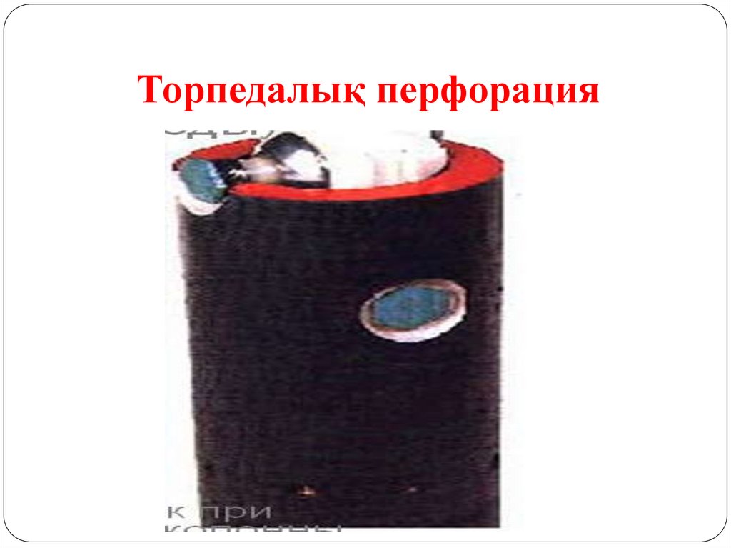 Торпедалық перфорация