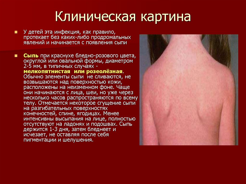 Клиническая картина