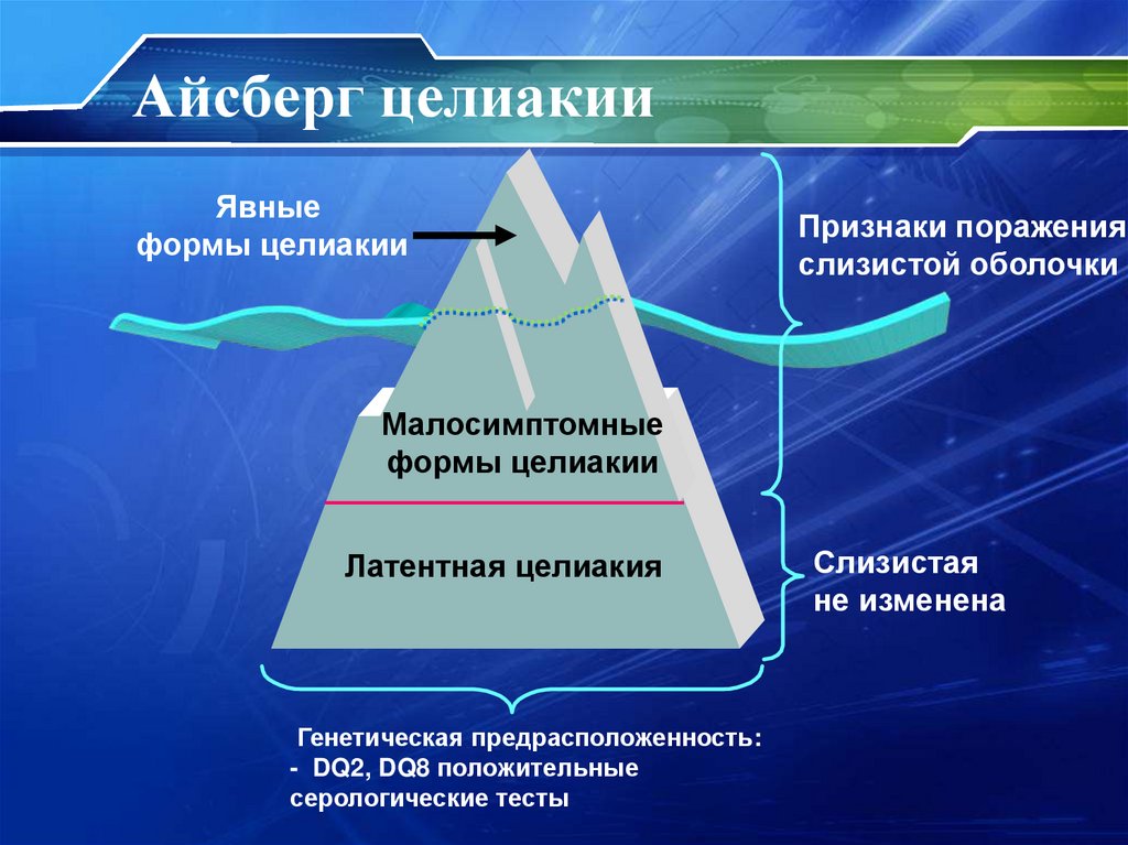 Айсберг целиакии