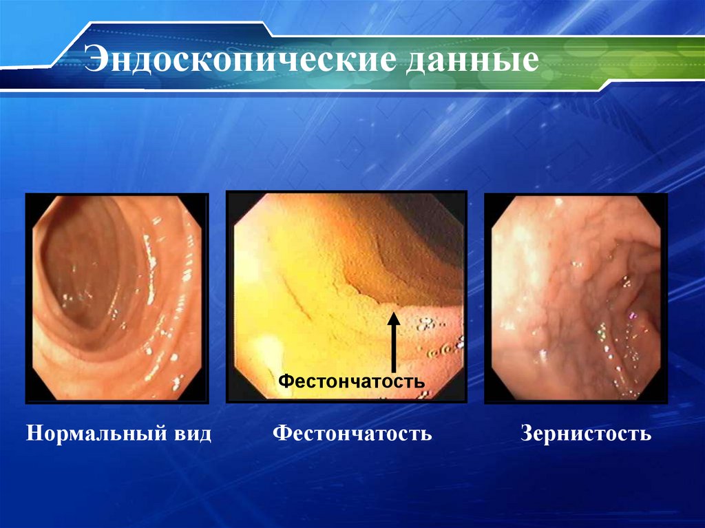 Эндоскопические данные