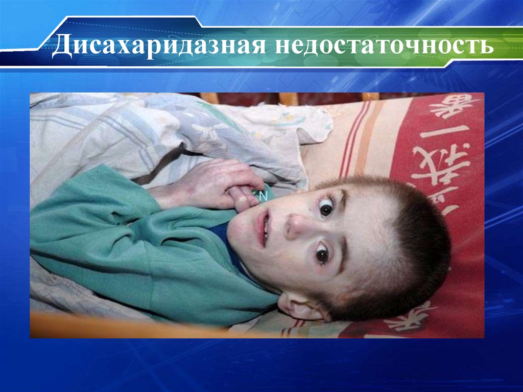 Дисахаридазная недостаточность