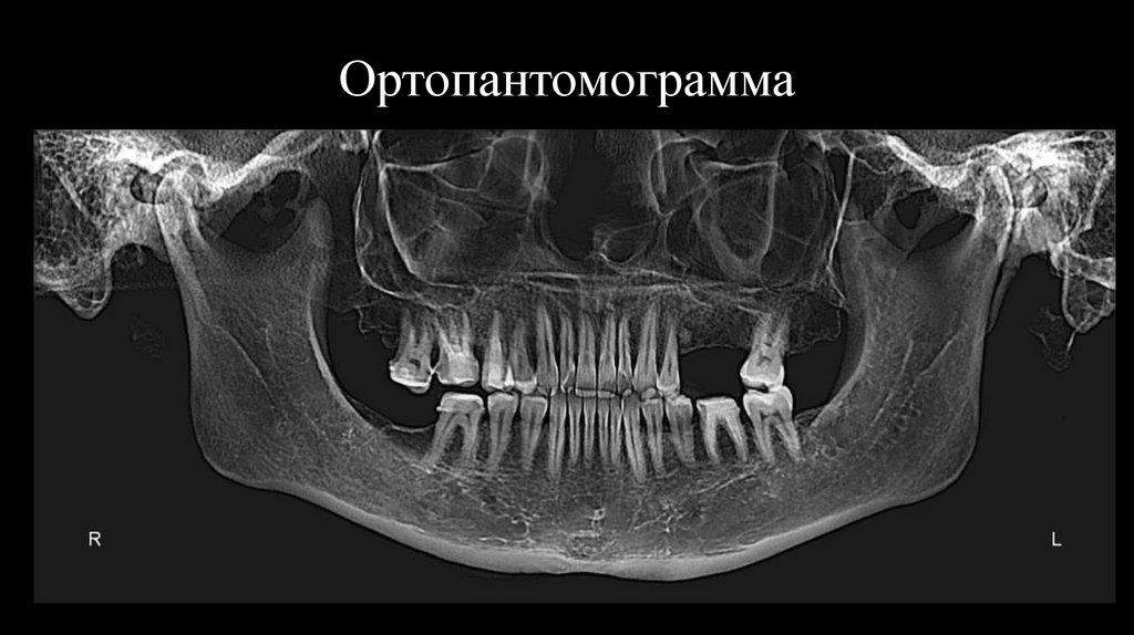 Ортопантомограмма