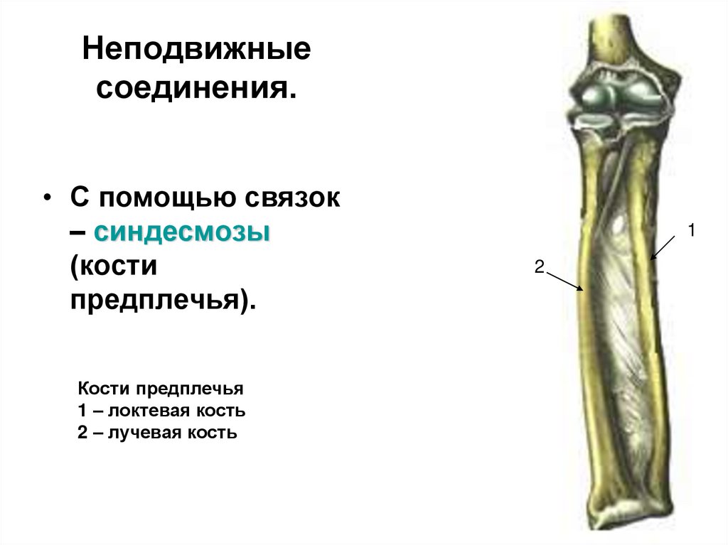 Неподвижные соединения.