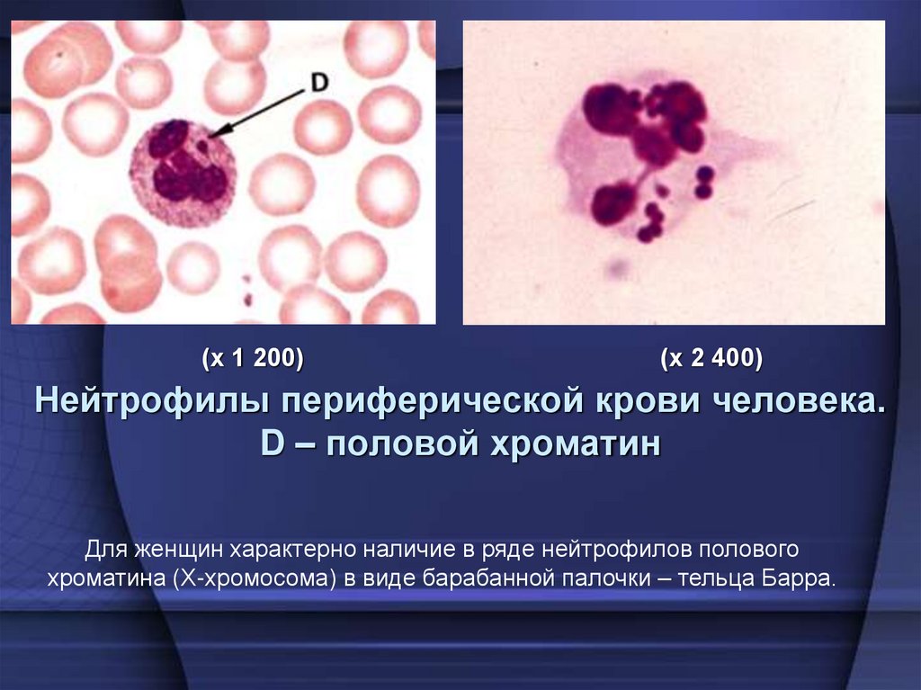 Нейтрофилы периферической крови человека. D – половой хроматин