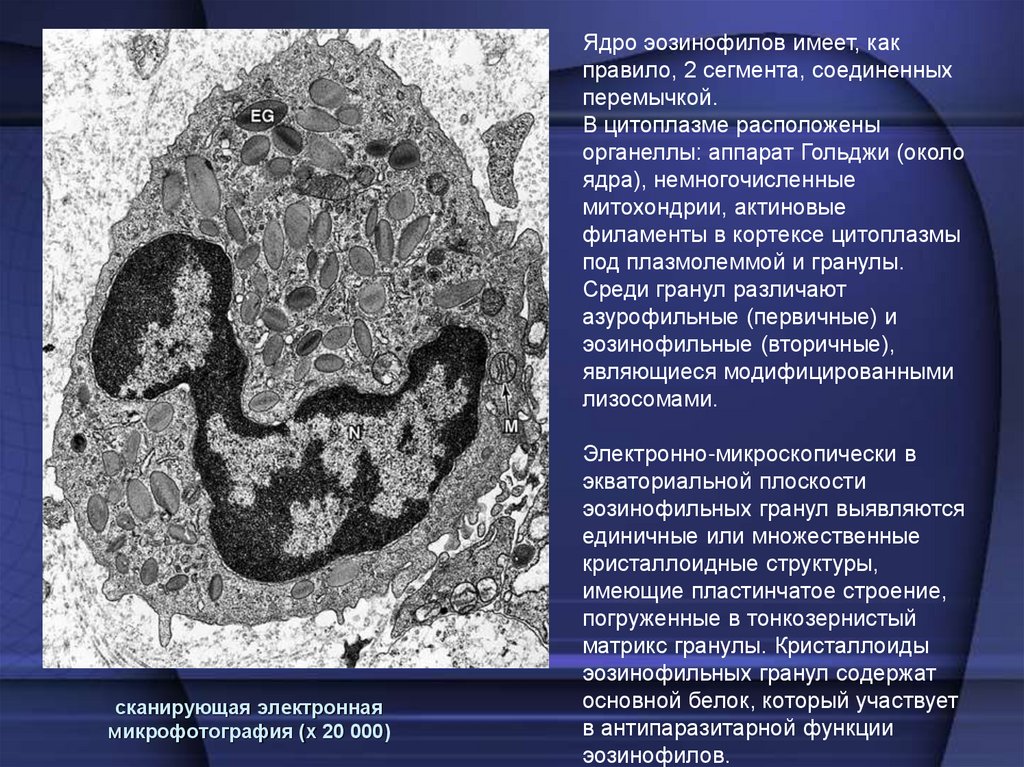 сканирующая электронная микрофотография (х 20 000)