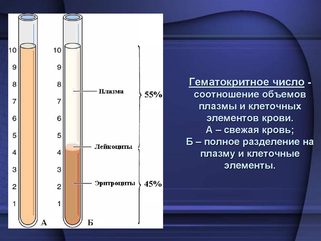 Гематокритное число - соотношение объемов плазмы и клеточных элементов крови. А – свежая кровь; Б – полное разделение на плазму