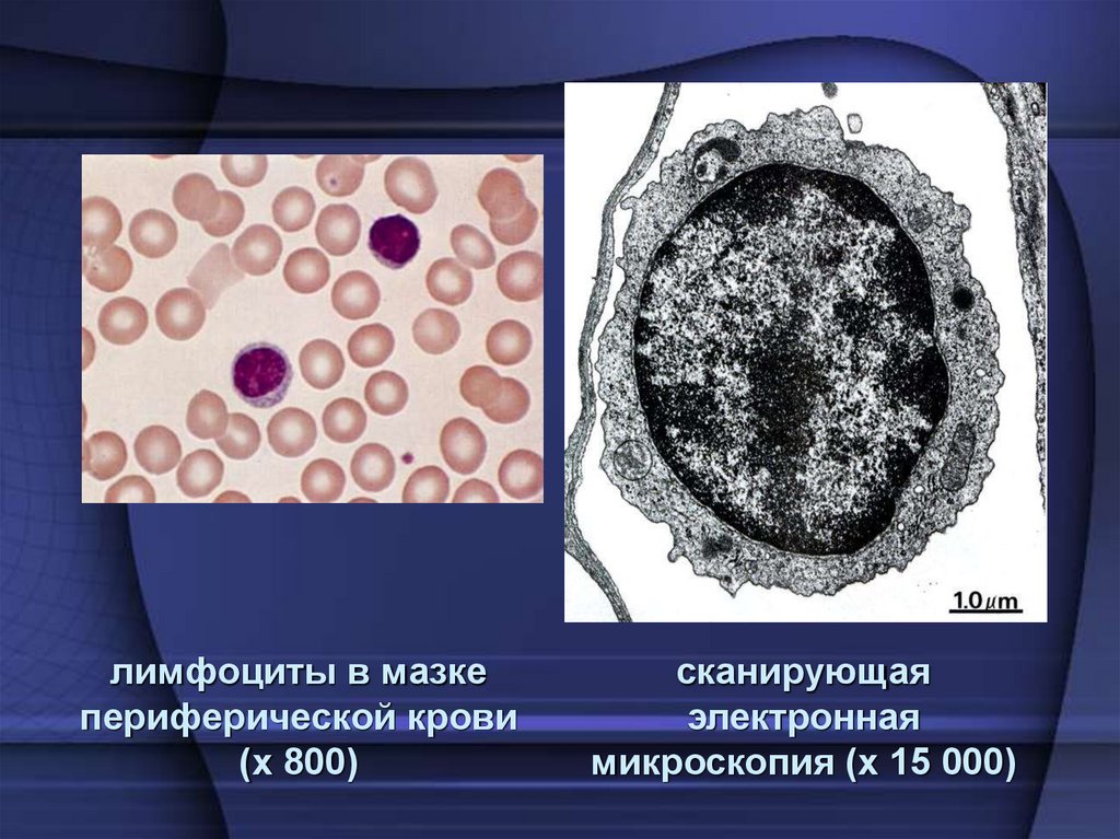 лимфоциты в мазке периферической крови (х 800)