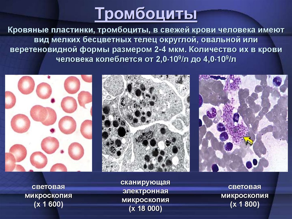 Кровяные пластинки, тромбоциты, в свежей крови человека имеют вид мелких бесцветных телец округлой, овальной или веретеновидной