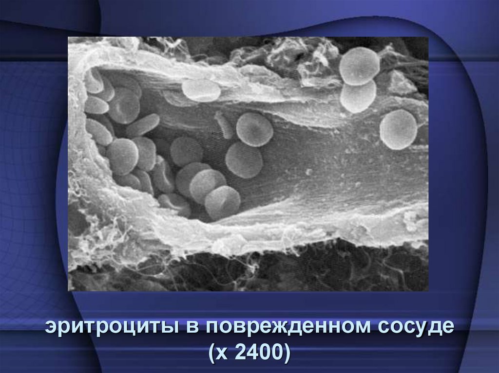 эритроциты в поврежденном сосуде (х 2400)