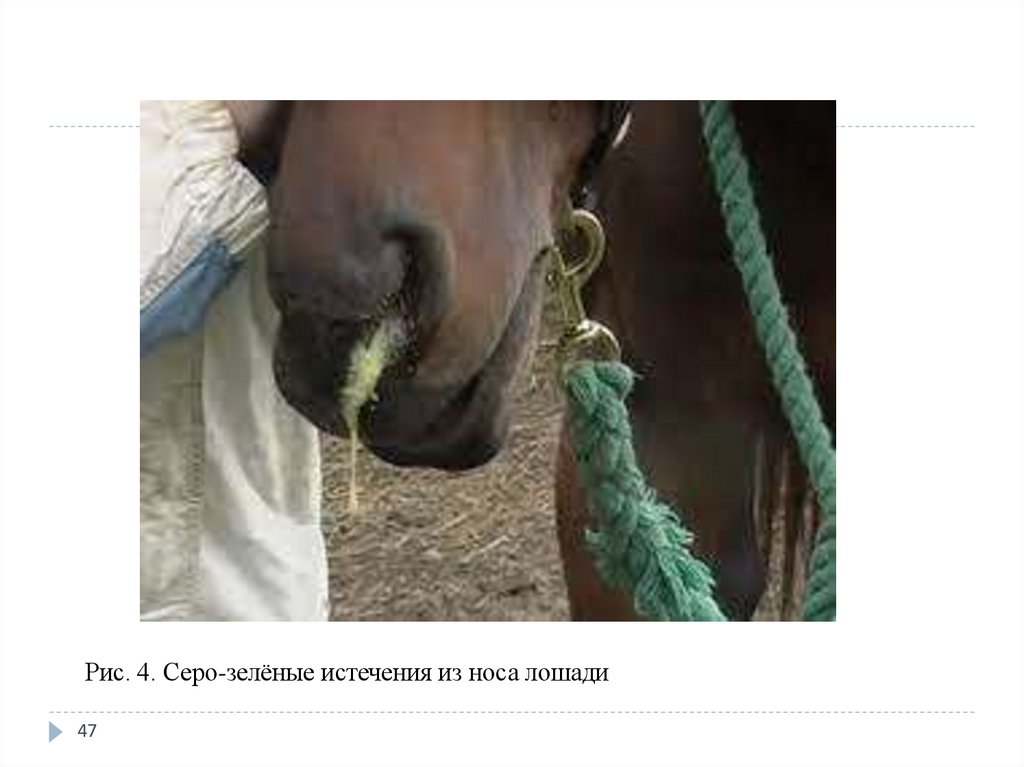 Гнилостная пневмония (гангрена легких) — Pneumonia putrida (Gangrena pulmonum)