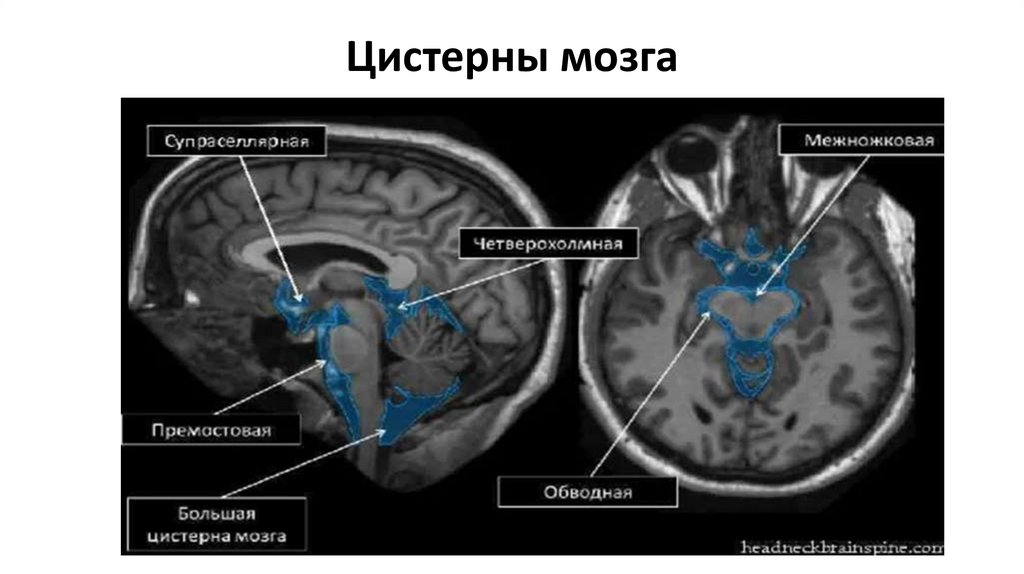 Цистерны мозга