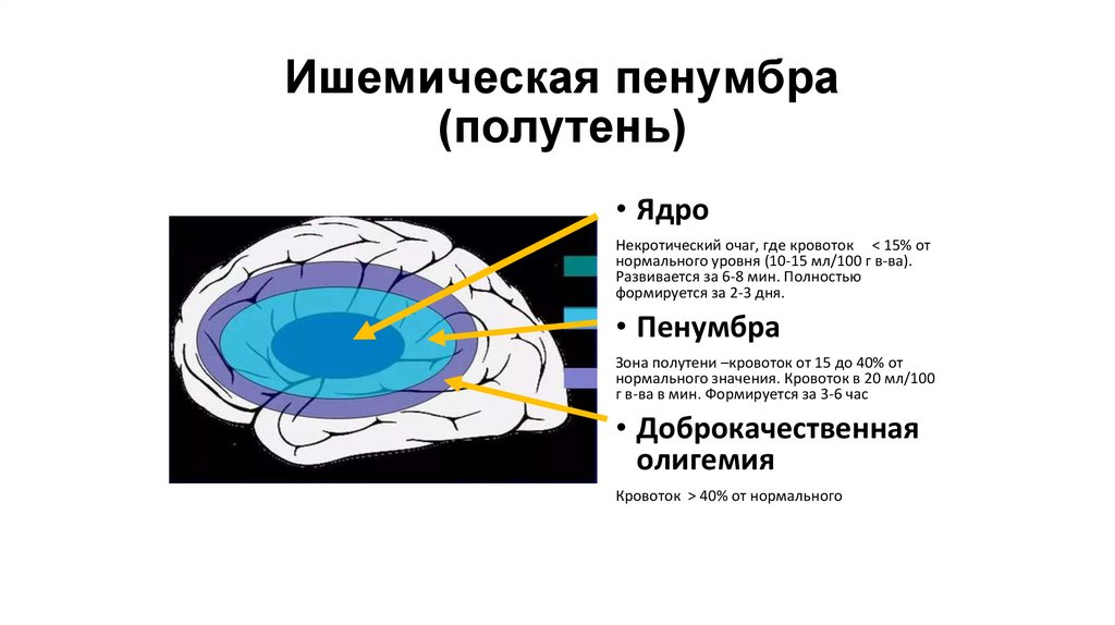 Ишемическая пенумбра (полутень)