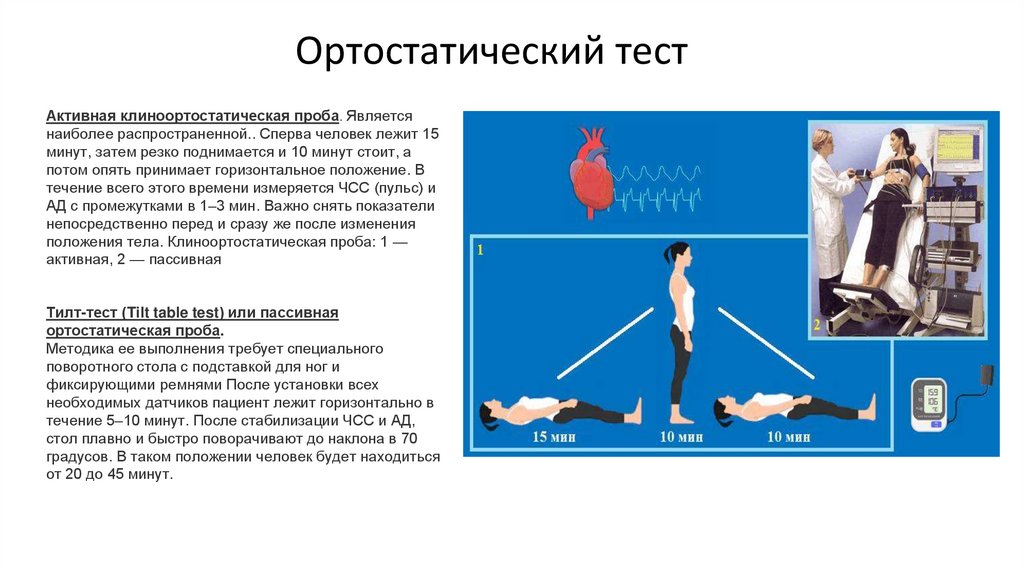 Ортостатический тест