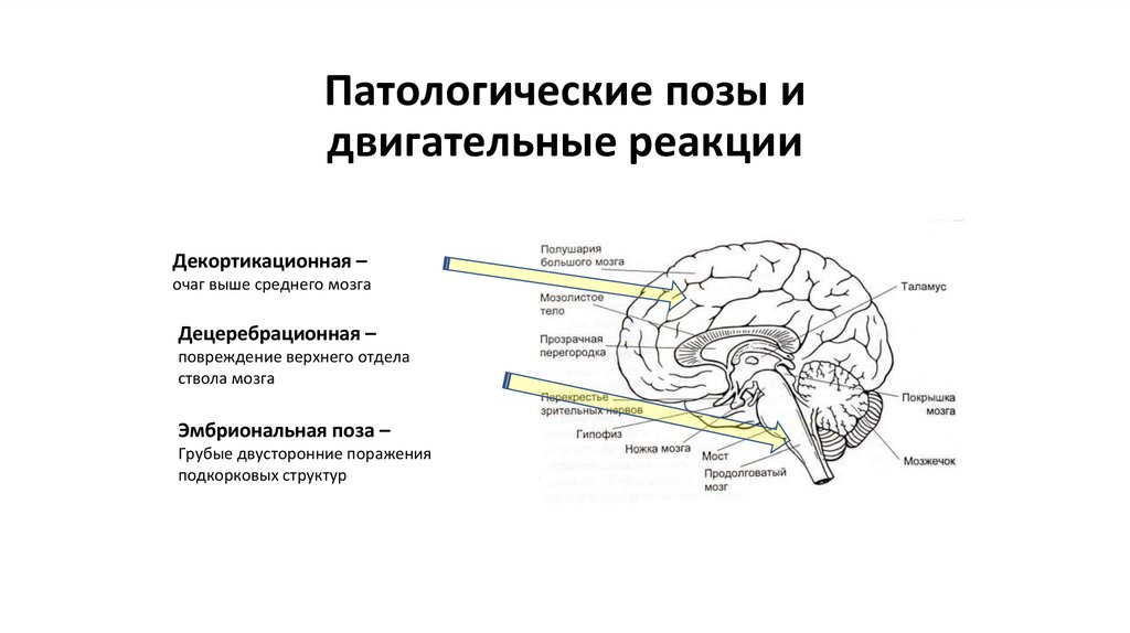 Патологические позы и двигательные реакции