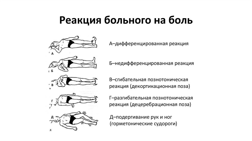 Реакция больного на боль