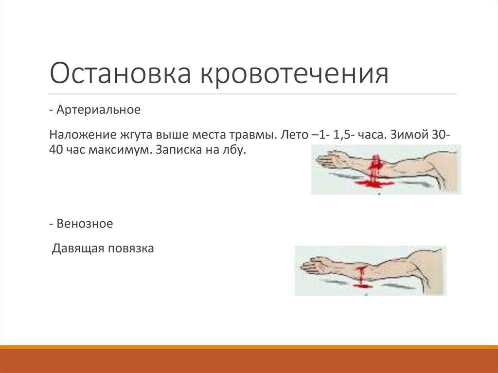 Остановка кровотечения