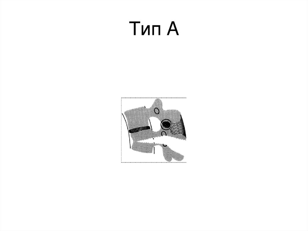 Тип A