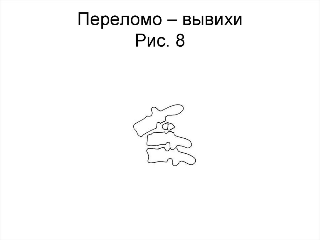 Переломо – вывихи Рис. 8