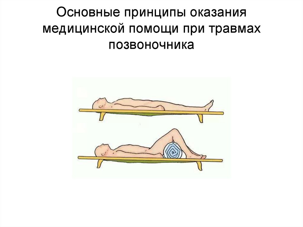 Основные принципы оказания медицинской помощи при травмах позвоночника