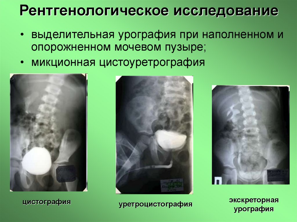Рентгенологическое исследование