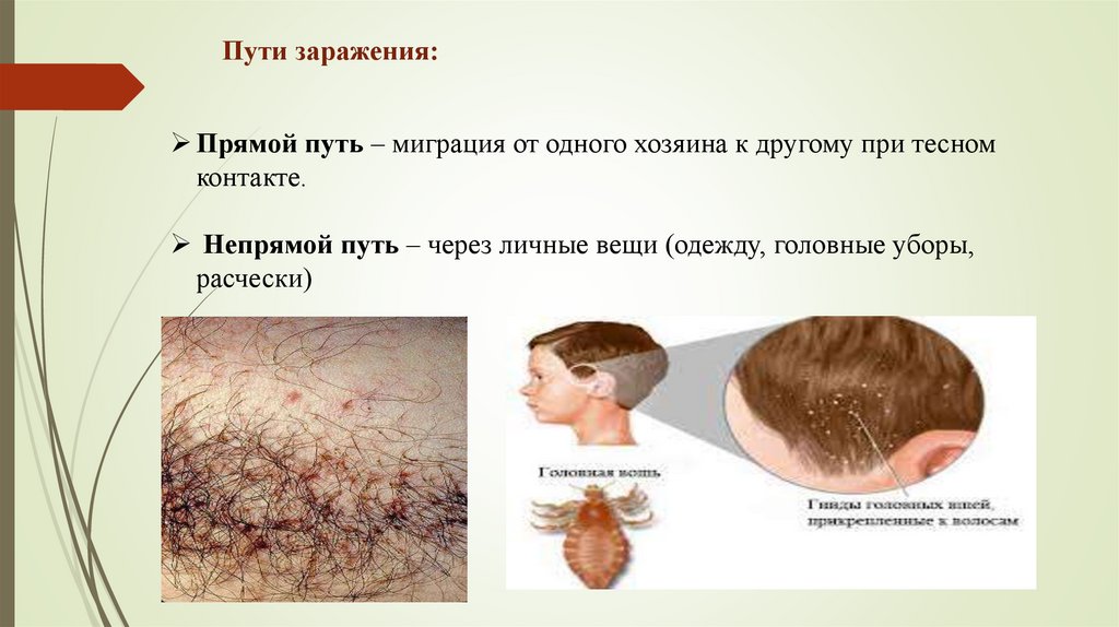 Пути заражения: